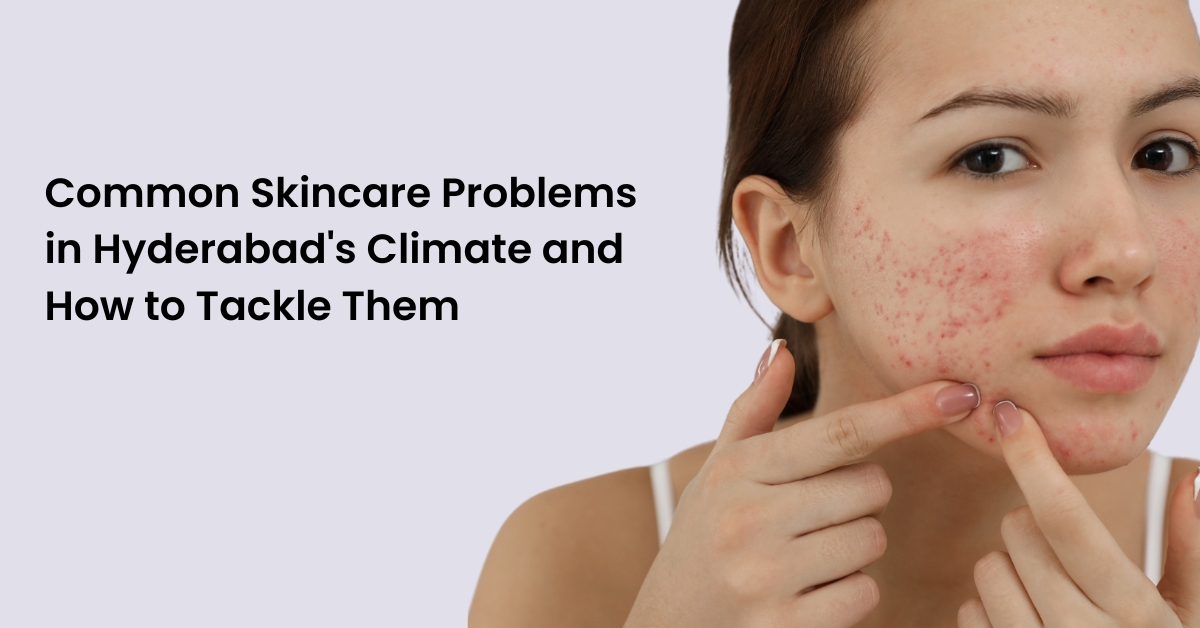 Skincare Problems in Hyderabad