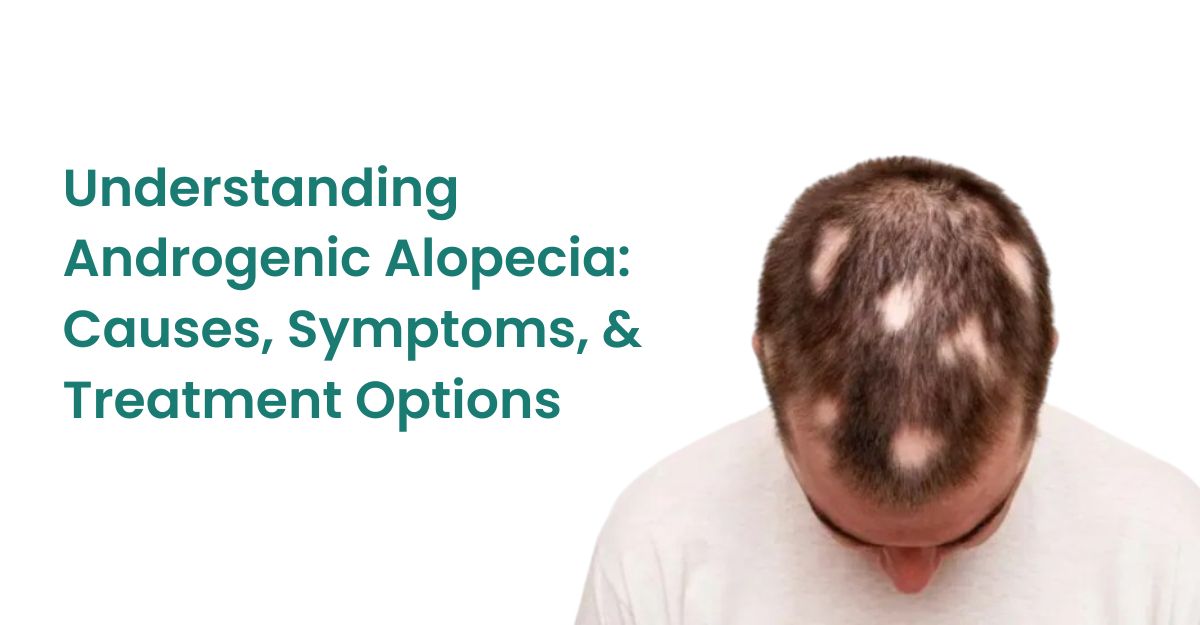 Androgenic Alopecia: Causes, Symptoms, & Treatment Options