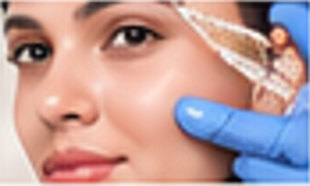 Medium-depth chemical peel treatment
