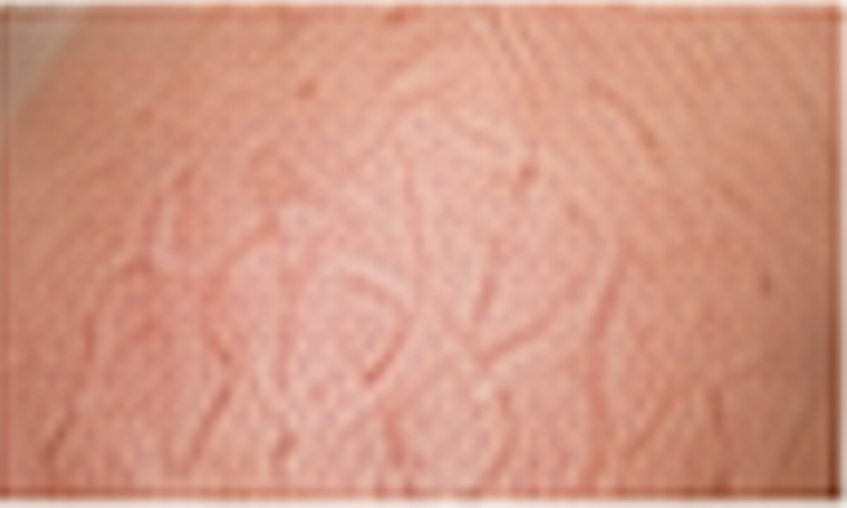 Top moisturizers for dry and rough skin