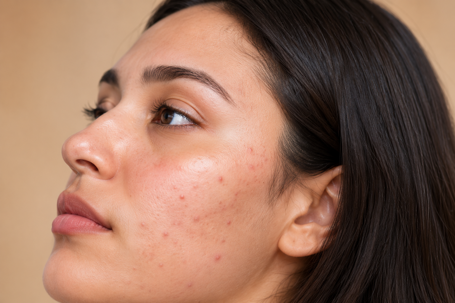 Pigmentation and dark spots on cheek
